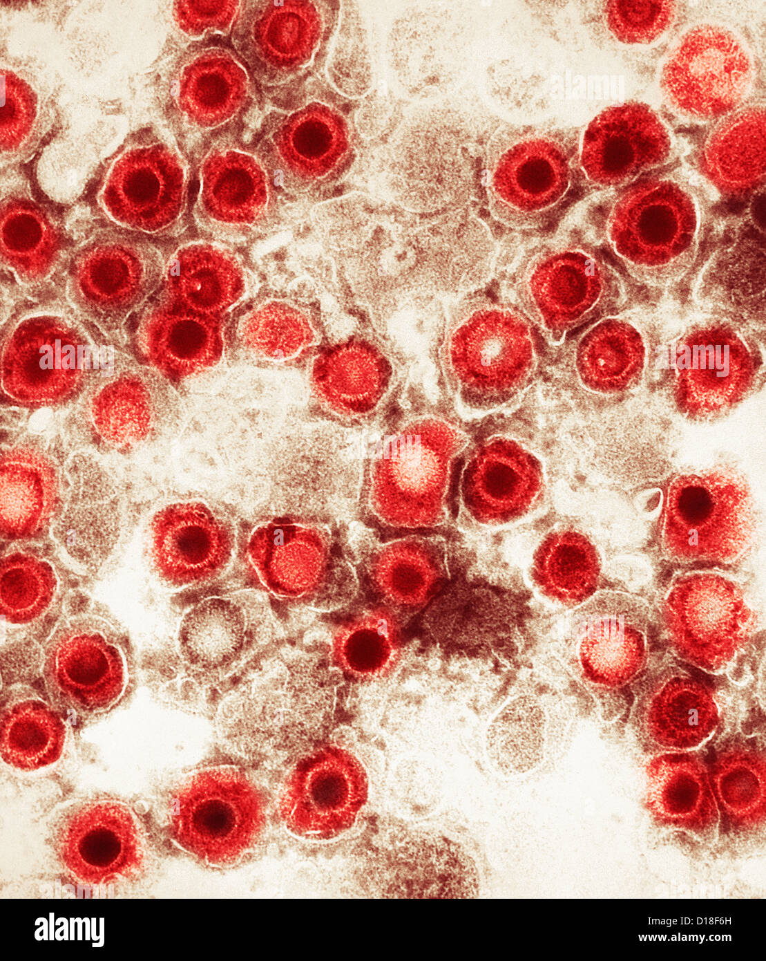Micrografía de electrones, herpes virus Foto de stock