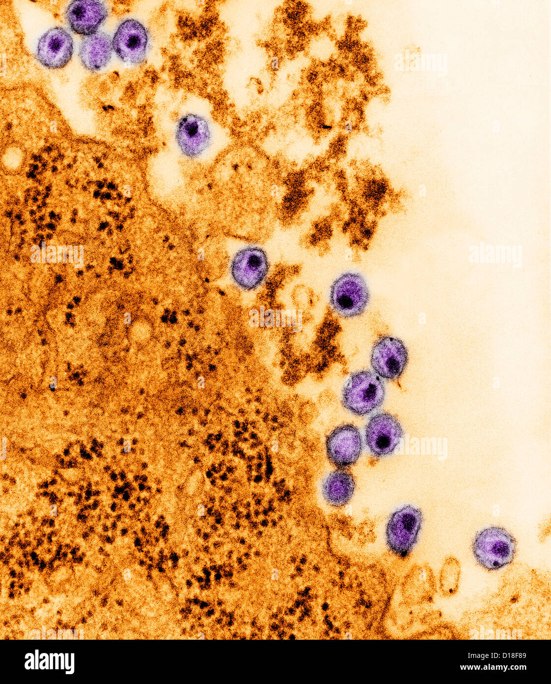 Micrografía de electrones del virus del VIH Foto de stock