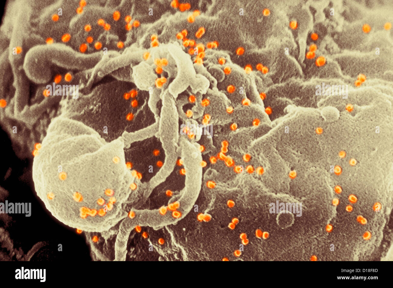 Micrografía electrónica de brotación virus VIH Foto de stock