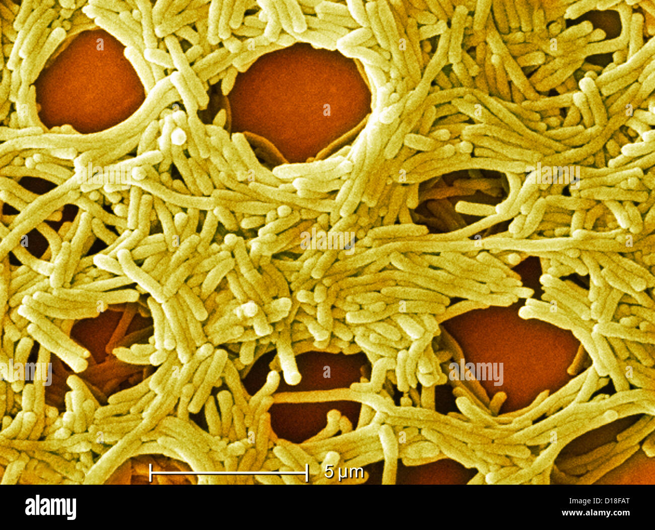 Micrografía de electrones de la bacteria Legionella, 6500x Foto de stock