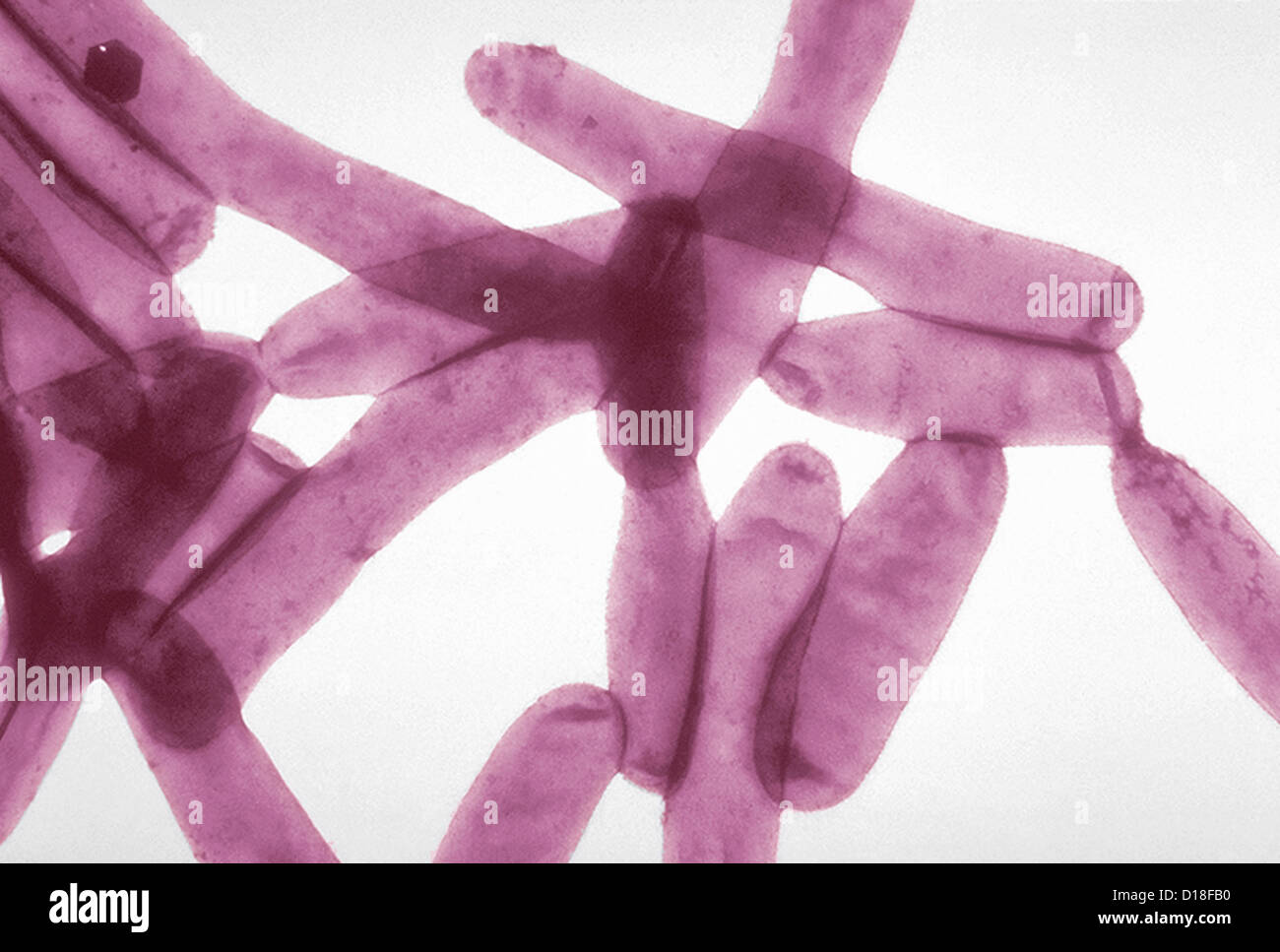 Micrografía de electrones de la bacteria Legionella, 6500x Foto de stock