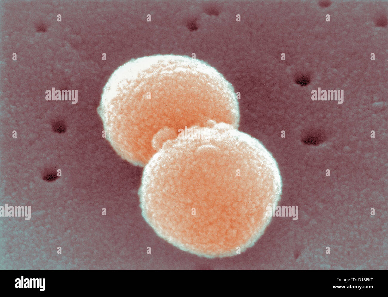 Micrografía de electrones de Streptococcus pneumoniae. Foto de stock