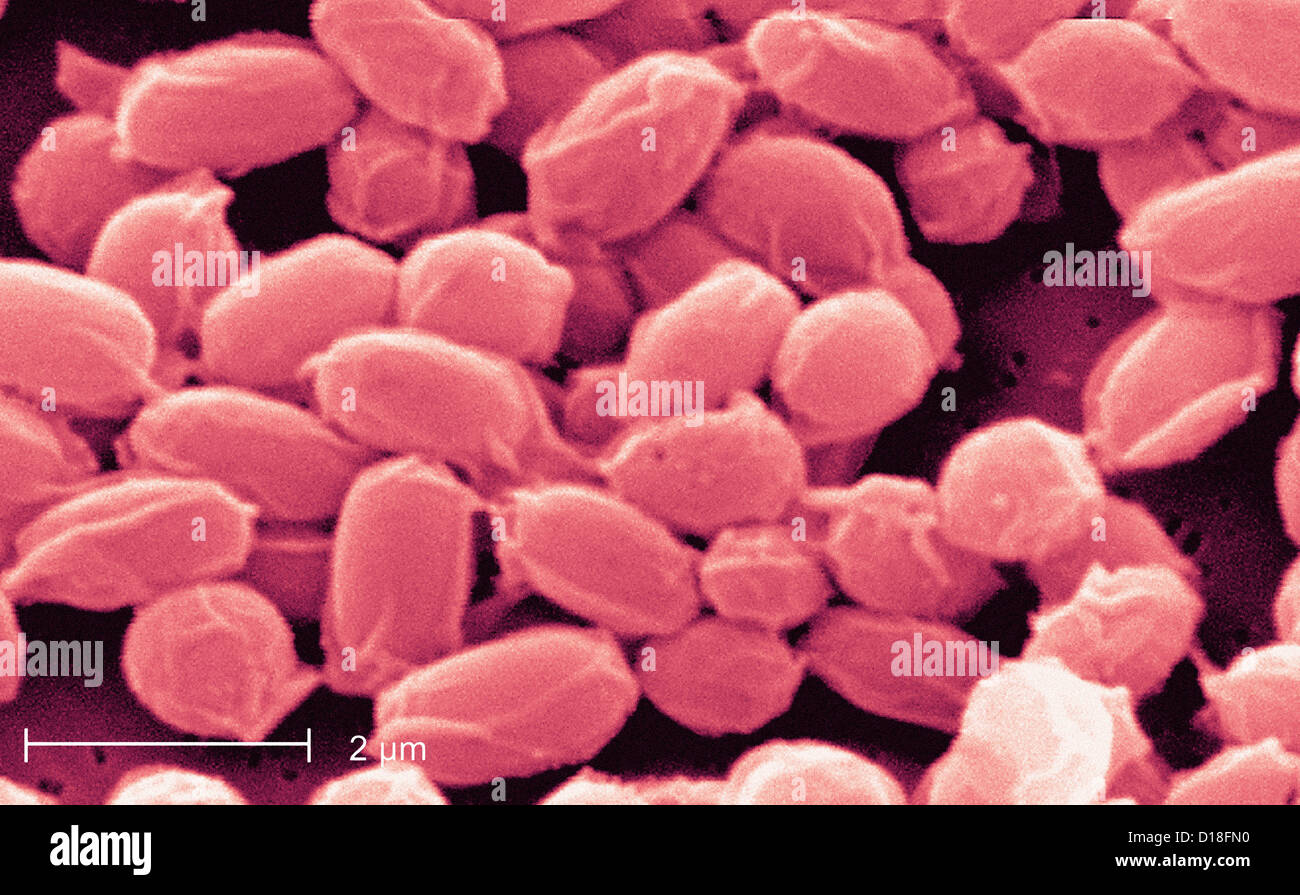 Micrografía de electrones de Bacillus anthracis es una bacteria Foto de stock