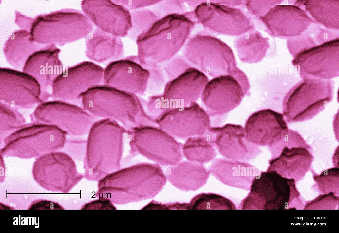 Micrografía de electrones de Bacillus anthracis es una bacteria Foto de stock
