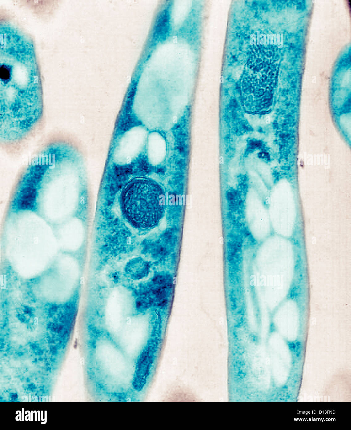Micrografía de electrones de Bacillus anthracis es una bacteria Foto de stock