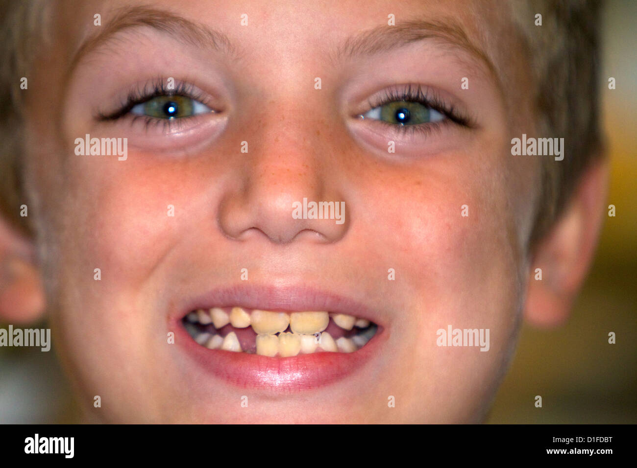 Niño de siete años con el diente que falta. Foto de stock