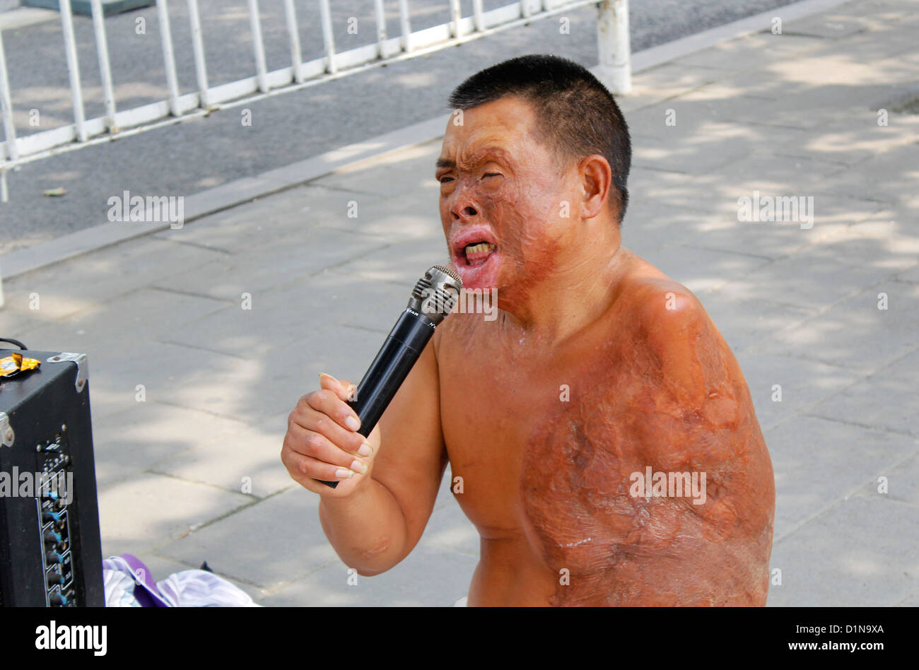 Un hombre sin hogar quemado cicatrizado bagger sin extremidades karayoki cantando en la calle por dinero en Pekín, China Foto de stock
