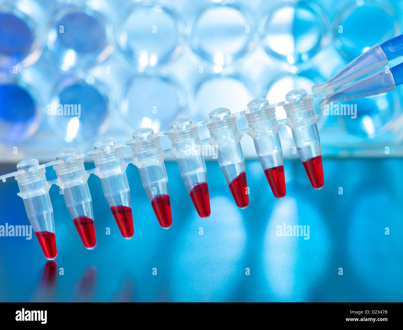 Las muestras de sangre para determinar la paternidad, utilizando el ADN Foto de stock
