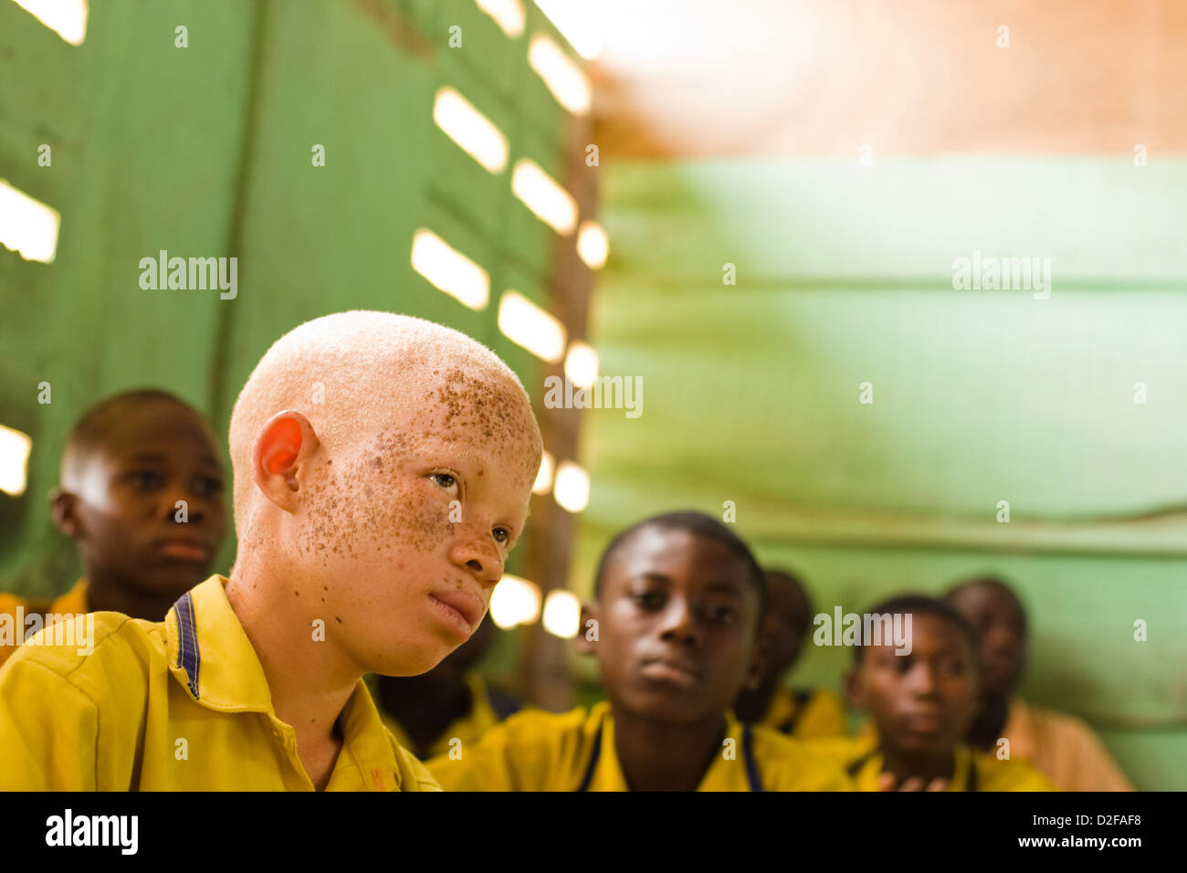 Albino muchacho sentado entre sus pares en un aula. Foto de stock