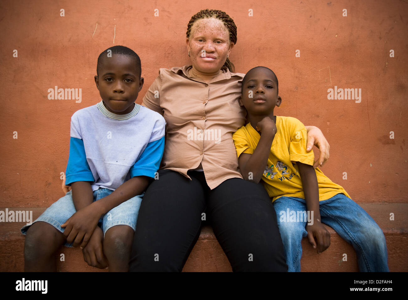 Albino africano mujer y sus dos hijos. Foto de stock