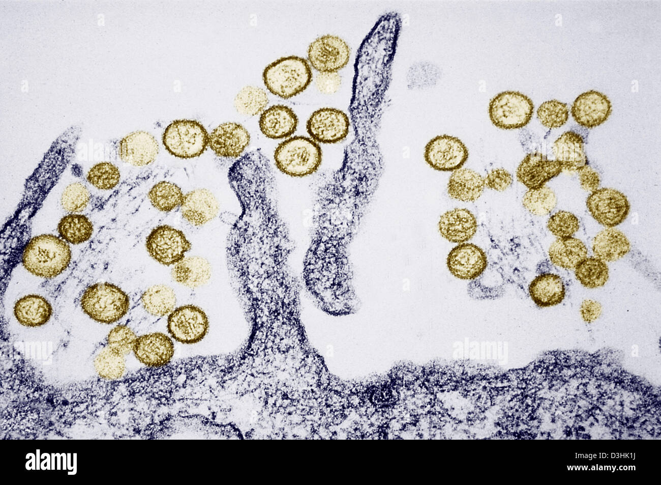 Sin nombre hantavirus fotografías e imágenes de alta resolución Alamy