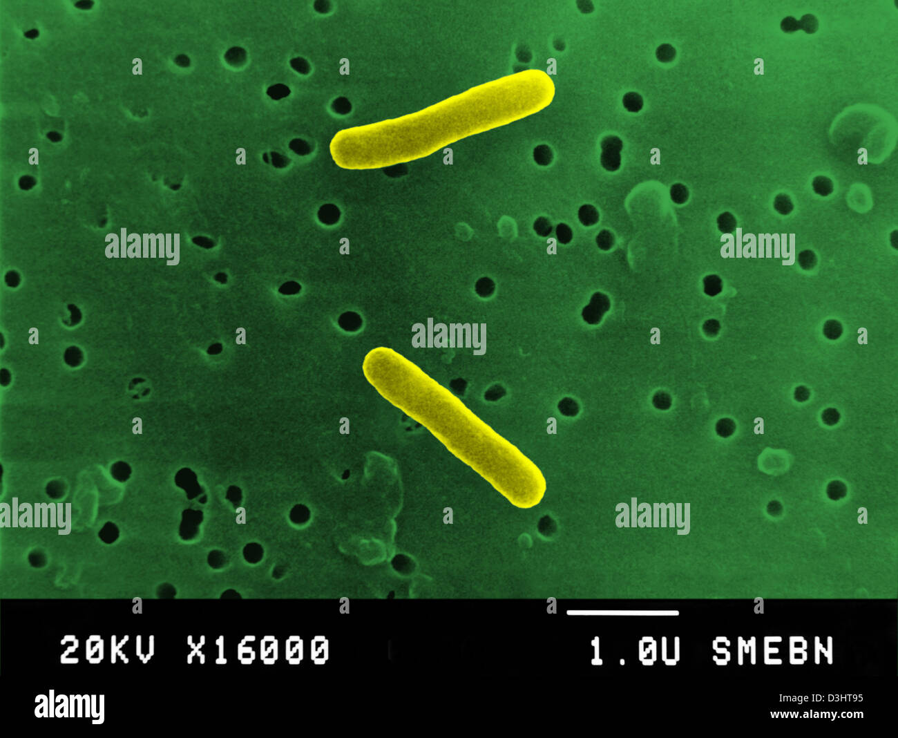 Salmonella typhi fotografías e imágenes de alta resolución Alamy