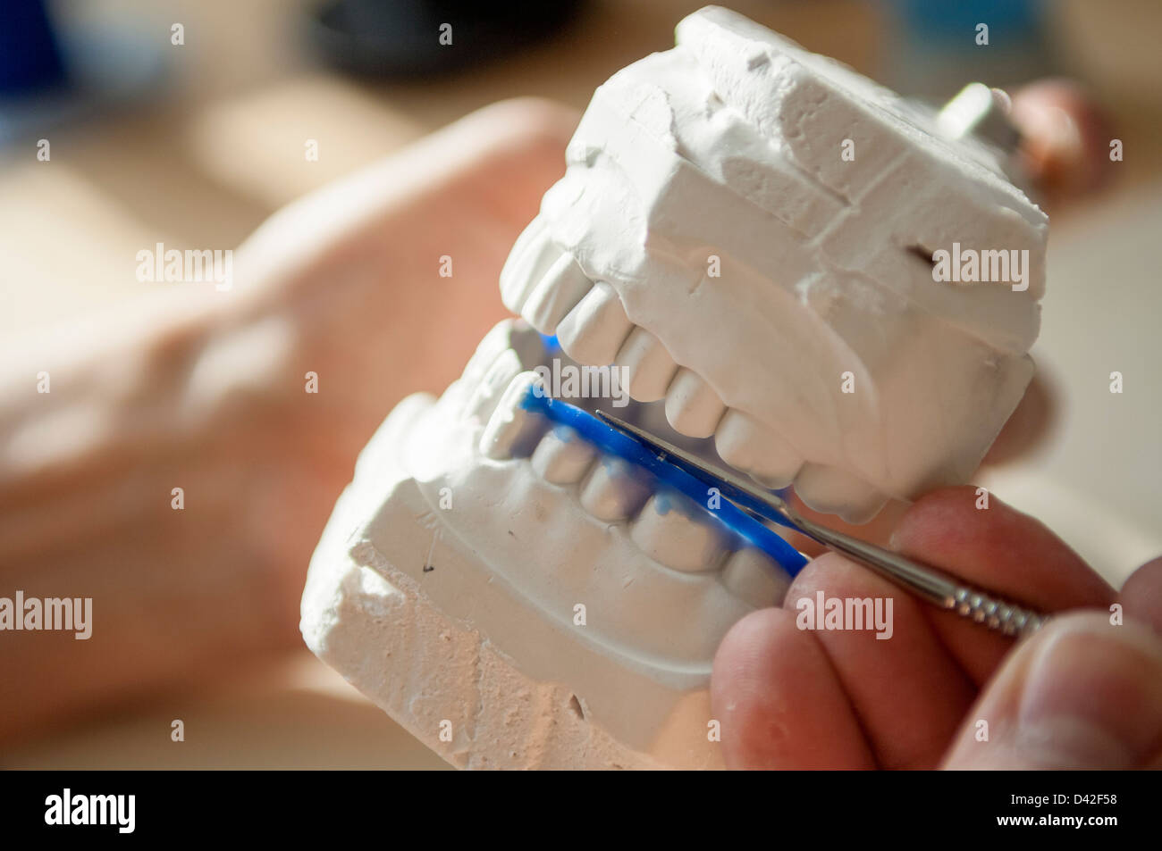 El técnico dental en el modelo de trabajo de dientes Fotografía de stock -  Alamy