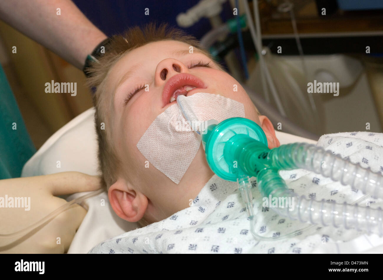 Cara de un joven sometidos a un procedimiento endoscópico. Foto de stock