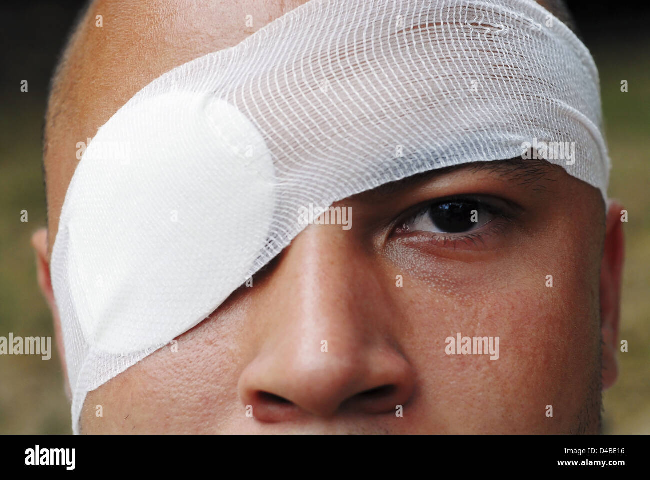 Así como se usa para tratar una lesión, parches en el ojo también pueden usarse para tratar un ojo perezoso. Foto de stock