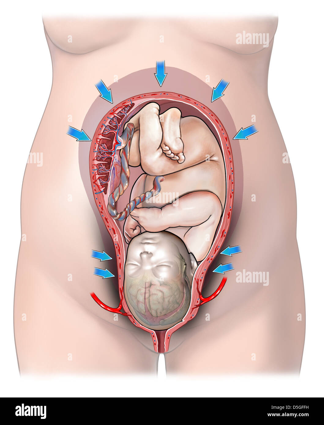 Las contracciones uterinas normales durante el parto Foto de stock