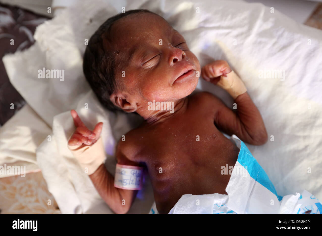 Recién nacido prematuro Baby Boy en la zona de maternidad del Hospital de la Sagrada Familia en Techiman, Ghana Foto de stock