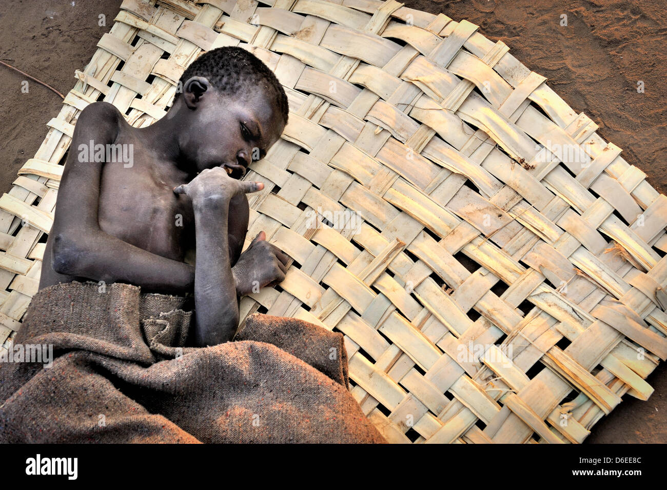 Patrick Anywar (14) está demacrado sobre una estera delante de una choza en el distrito de Kitgum, Uganda del Norte, 17 de enero de 2012. Padece enfermedad asintiendo con la cabeza, que es una enfermedad nueva y desconocida, que apareció por primera vez en Sudán en 1980. Los enfermos, los niños de entre cinco y 15 años de edad, son físicamente y mentalmente retardado. La mayoría de los casos, por el momento están en el norte de Uganda y sur de Sudán. Foto de stock