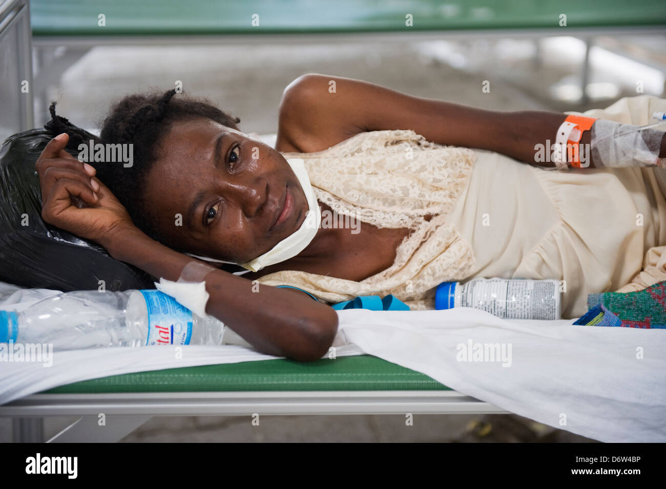TB VIH sufriente, paciente del hospital tras el terremoto de enero de 2010, el Hospital General de Port-au-Prince, Haití, el Caribe Foto de stock