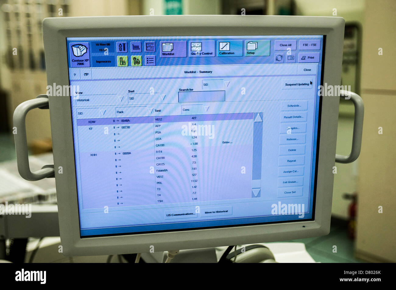 Un monitor utilizado en las pruebas y el análisis de muestras de sangre. Foto de stock