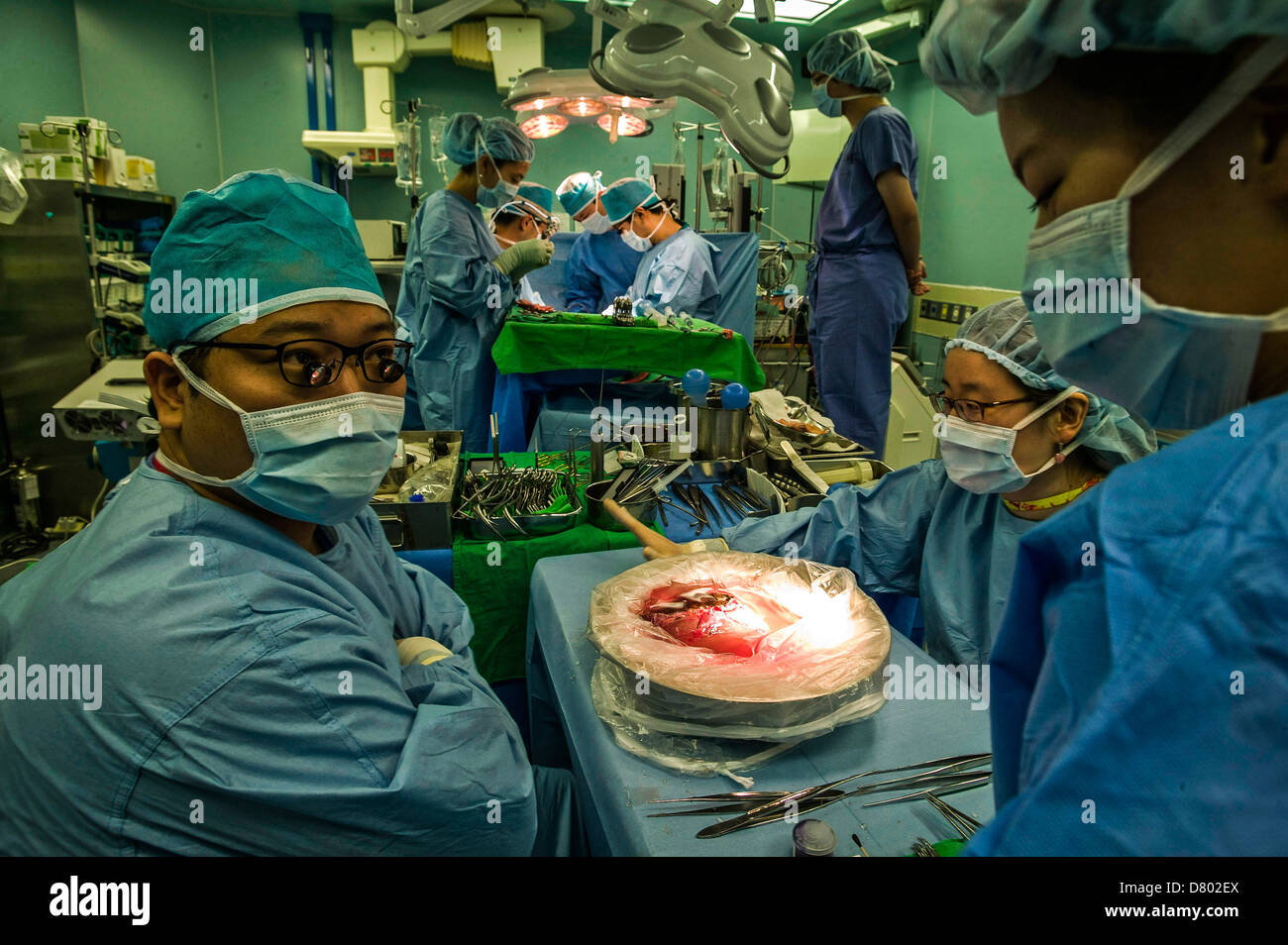Los cirujanos que realizan un trasplante de hígado. Foto de stock