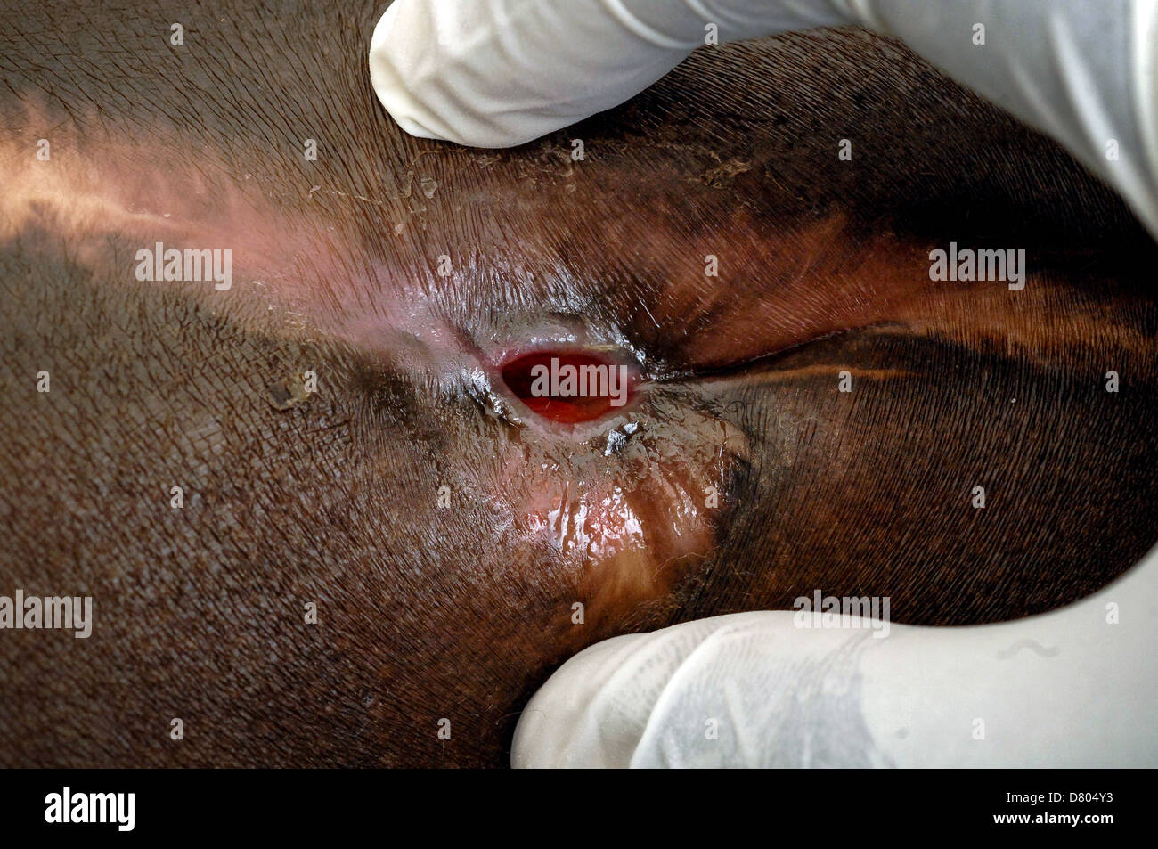 Un dermatólogo examina el proceso de cicatrización de una herida causada por micetoma. Foto de stock