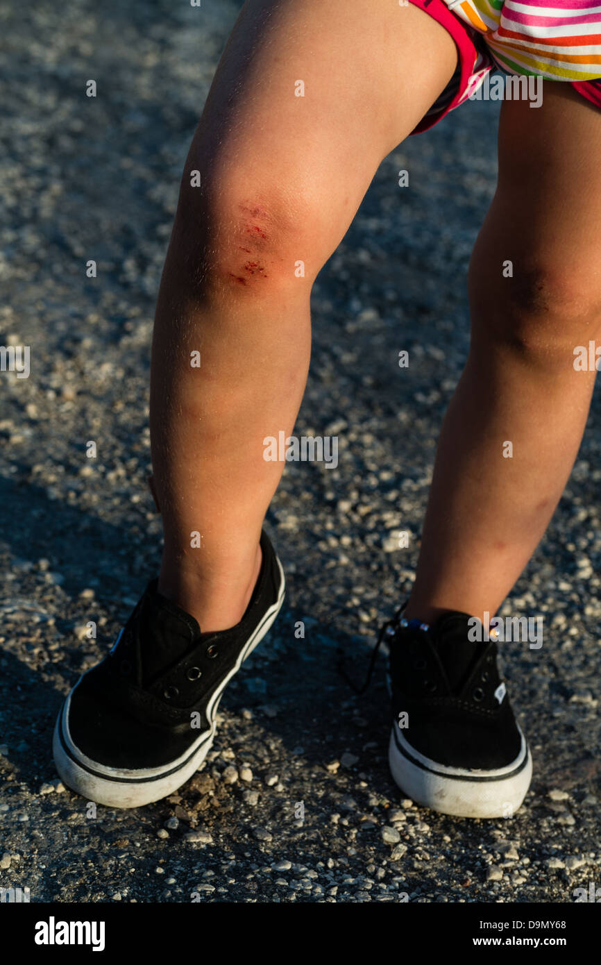 Child blood knee fotografías e imágenes de alta resolución - Alamy