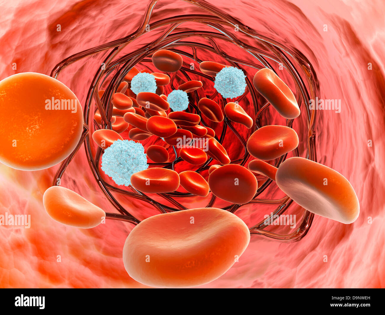 Vista microscópica del flujo de sangre dentro de una arteria con stent de la implementación. Foto de stock