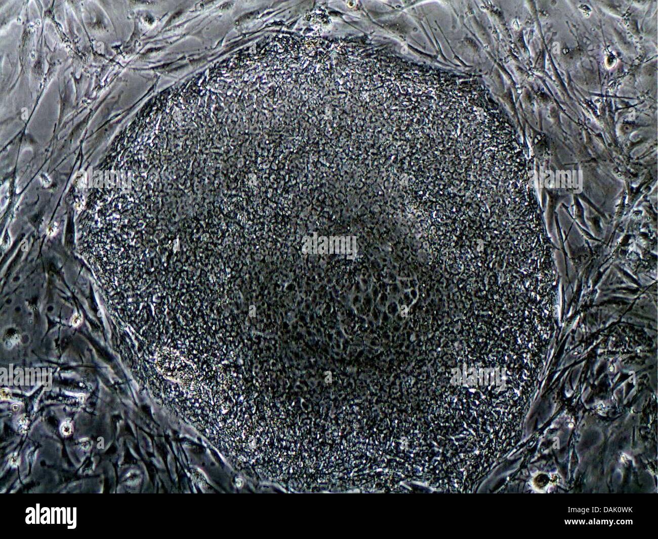 Programa - Un microscopio óptico sin fecha Folleto imagen del Instituto Max Planck de Biomedicina Molecular muestra una colonia de reprogramar células pluripotentes inducidas, células madre humanas en Muenster, Alemania. Numerosos científicos en el instituto de la Universidad de Münster están involucradas en la investigación con células madre. Foto: Mpi Muenster Foto de stock