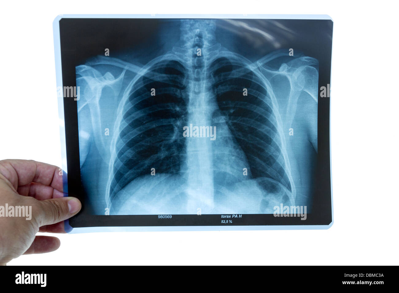 Médico examina una radiografía de torax Foto de stock