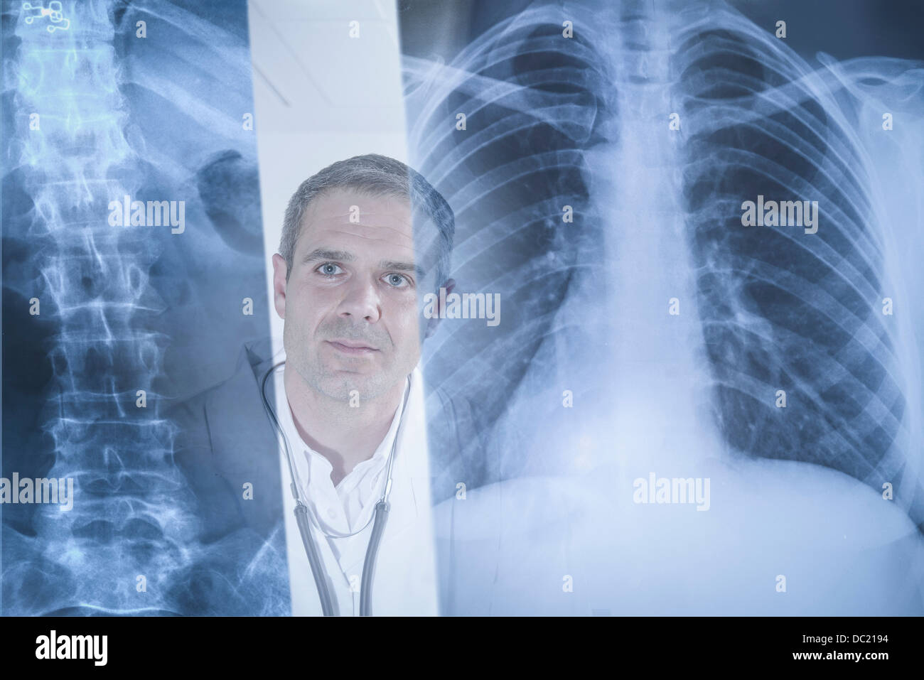 Médico examina los resultados de rayos x muestra en pantalla Foto de stock