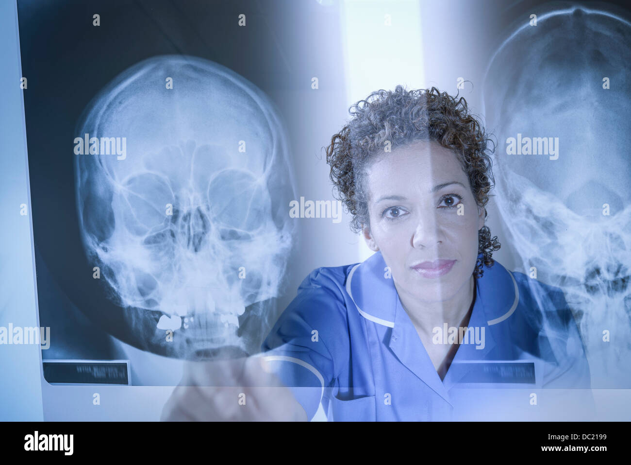 Enfermera apuntando a los resultados mostrados en la pantalla de rayos x Foto de stock