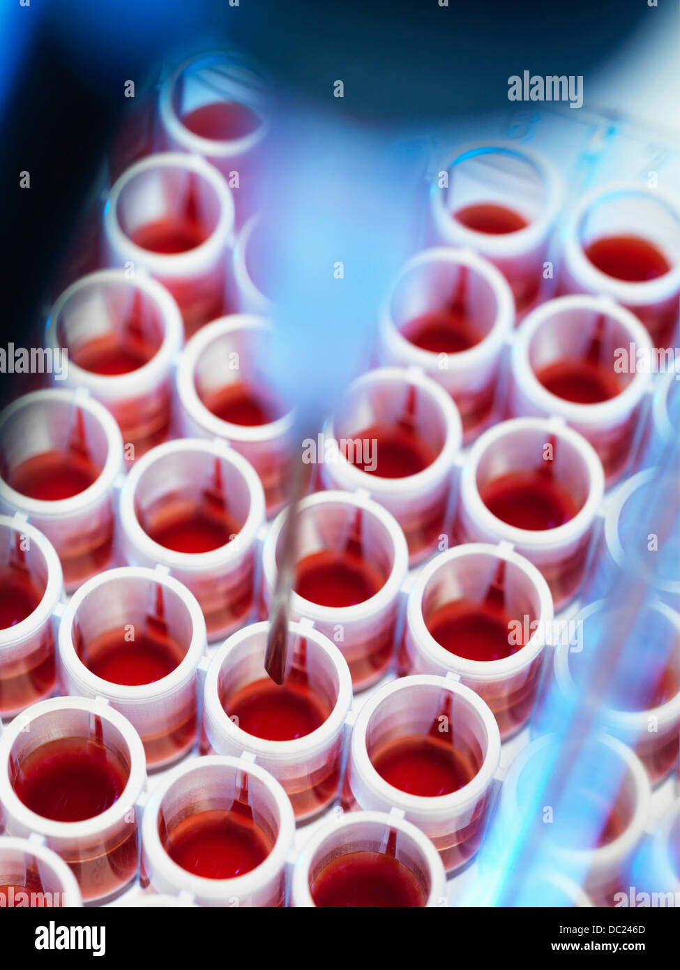 Tamizaje de sangre automatizado Foto de stock