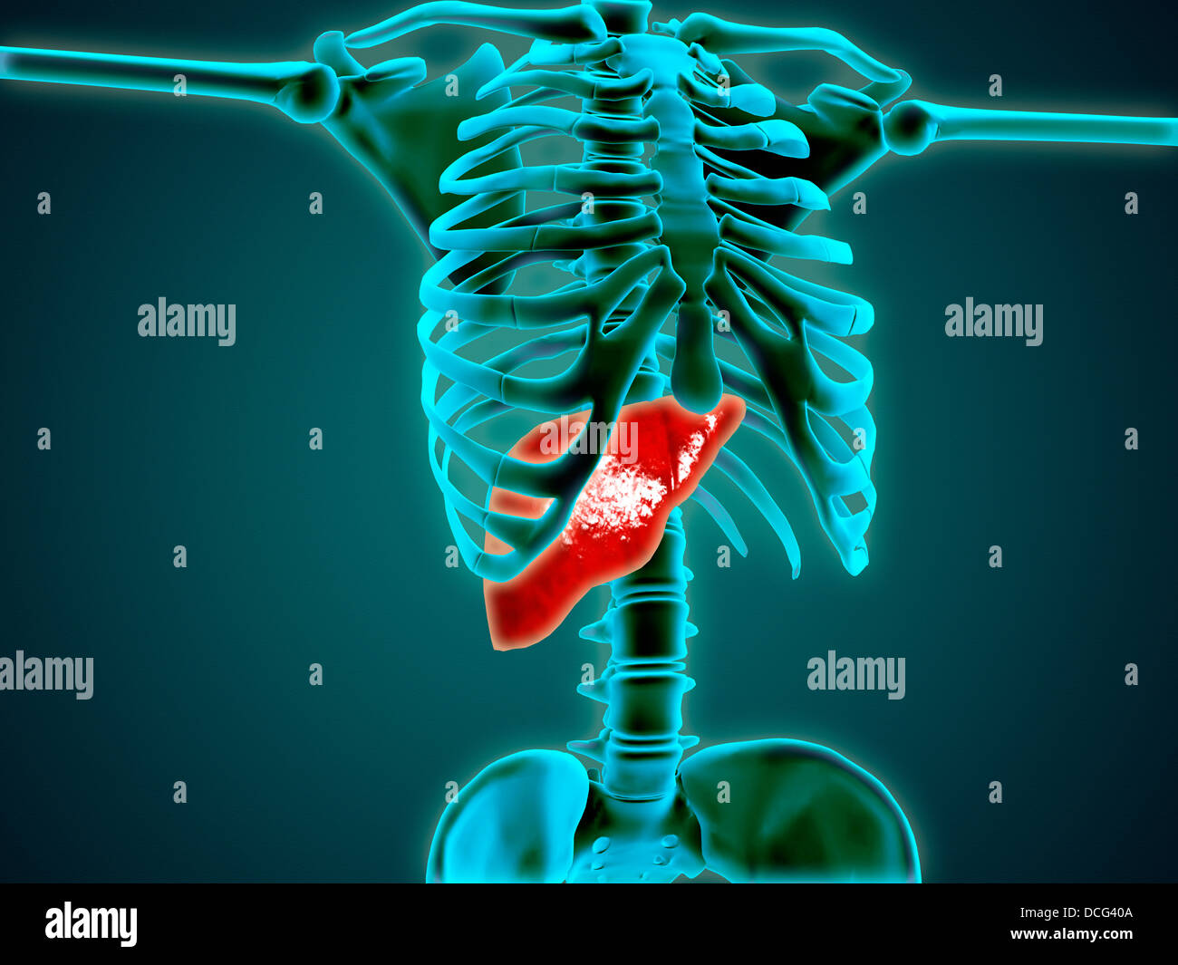Vista de rayos X del esqueleto humano con el hígado. Foto de stock