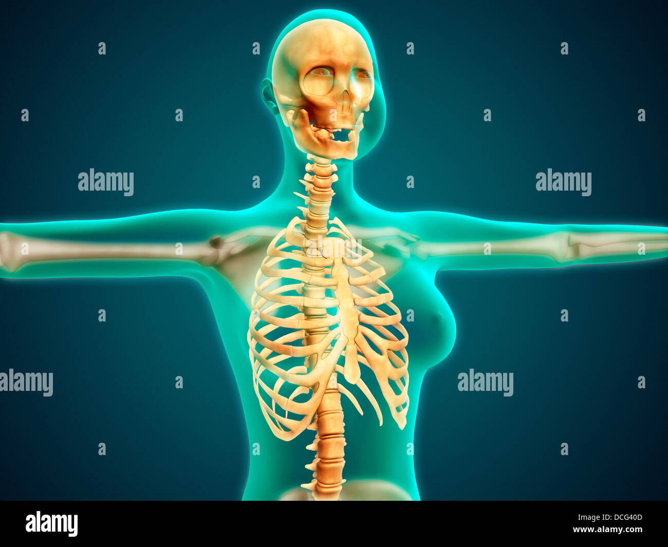 Vista de rayos X de la parte superior del cuerpo femenino mostrando la caja torácica, la columna vertebral y el cráneo. Foto de stock