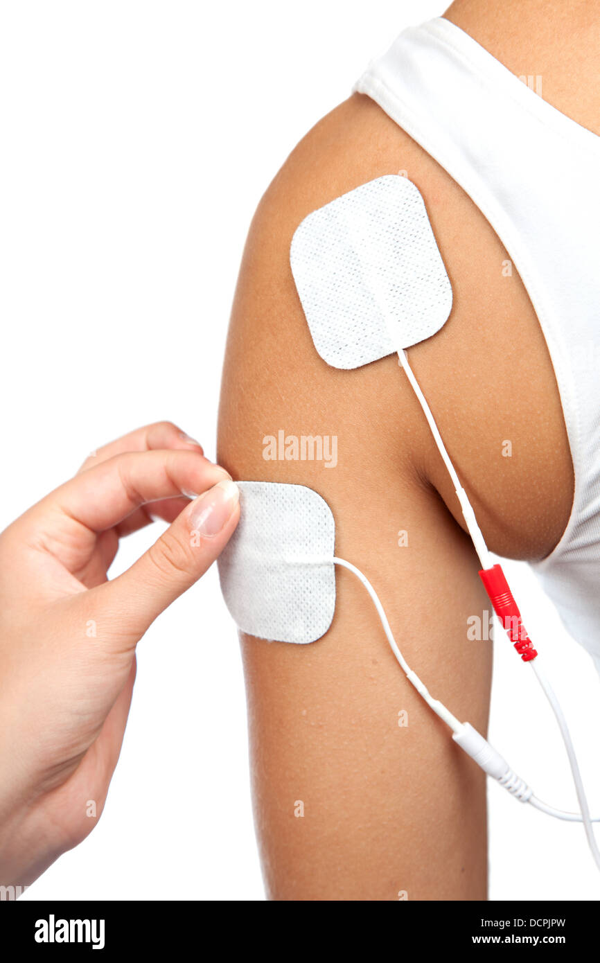 https://c8.alamy.com/compes/dcpjpw/electrodos-de-tens-tens-en-hombros-terapia-nervio-stimu-dcpjpw.jpg