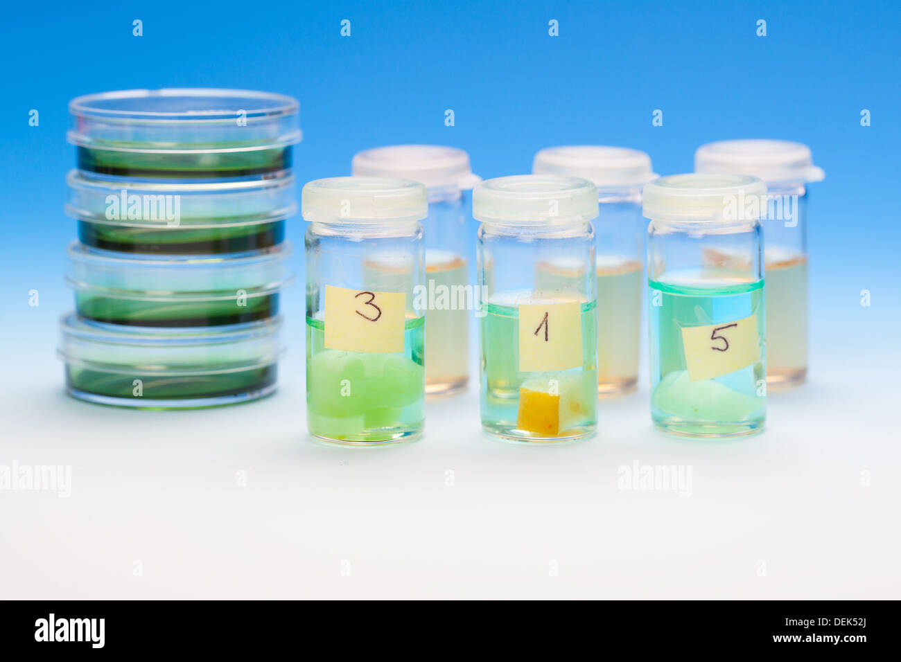Las muestras en frascos de plástico para microscopía y biopsia de tejido de laboratorio biológico. Foto de stock