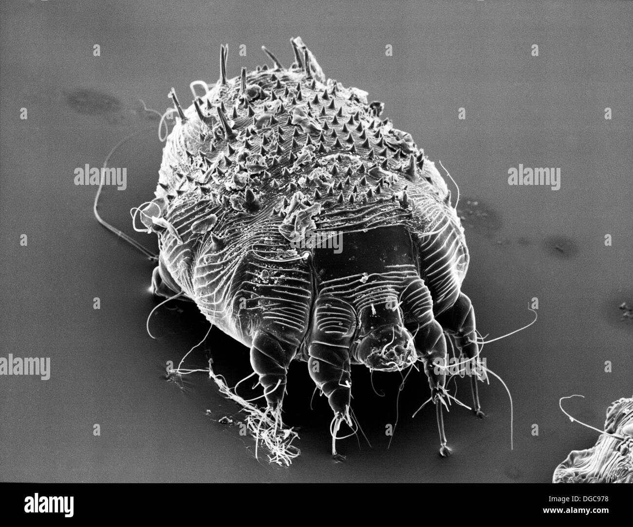 Ácaro, sarna, tiña (foto tomada con un microscopio electrónico Fotografía  de stock - Alamy
