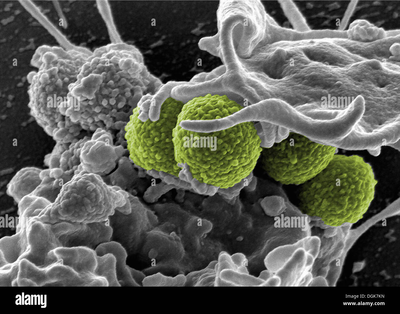 Las bacterias Staphylococcus aureus, MRSA Foto de stock