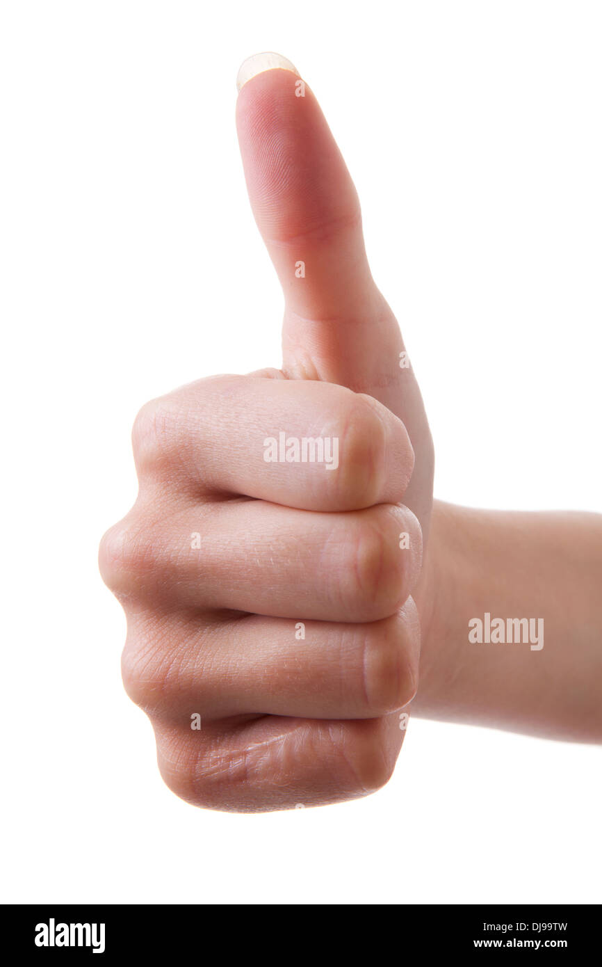 Mano con poco cicatriz pulgar hacia arriba sobre fondo blanco. Foto de stock