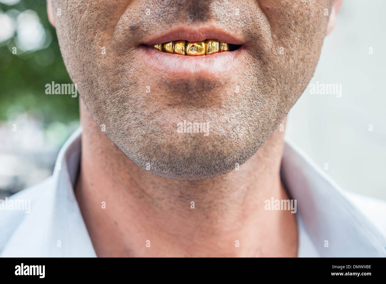 Hombre con los dientes de oro de prótesis dental Fotografía de stock - Alamy