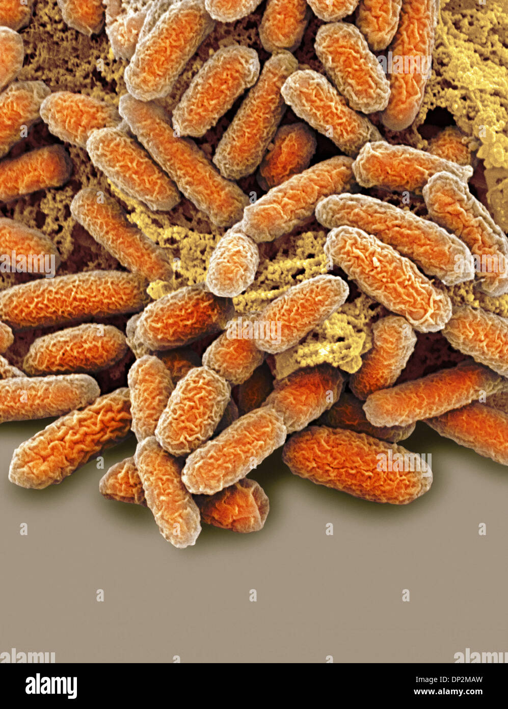 Las bacterias E. coli, SEM Foto de stock