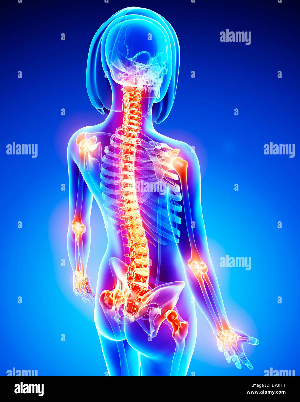 Dolor articular, ilustraciones Fotografía de stock Alamy