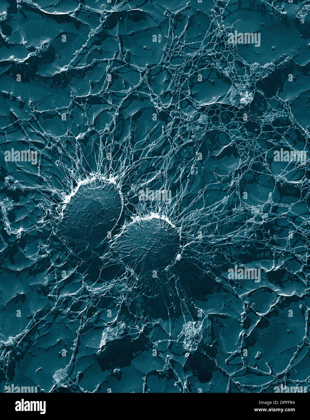 Las células bacterianas de Staphylococcus aureus Foto de stock