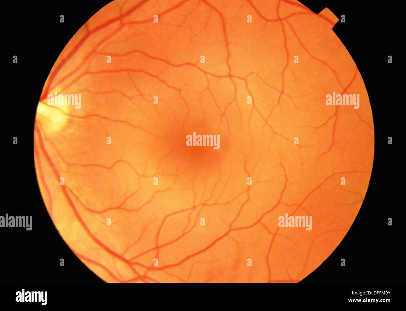 Retina Normal Fotos e Imágenes de stock Alamy