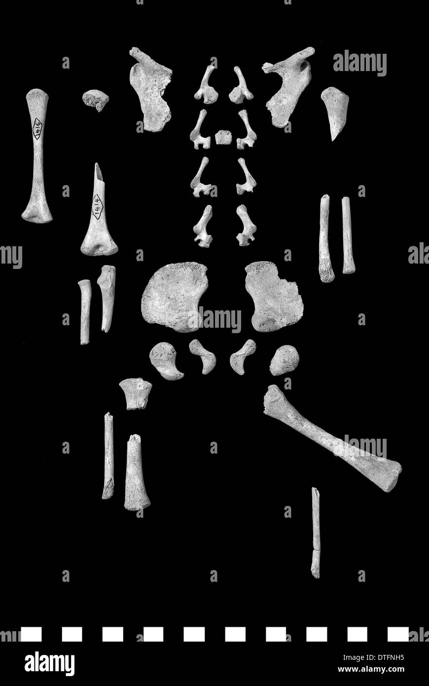 Esqueleto perinatal humano Foto de stock