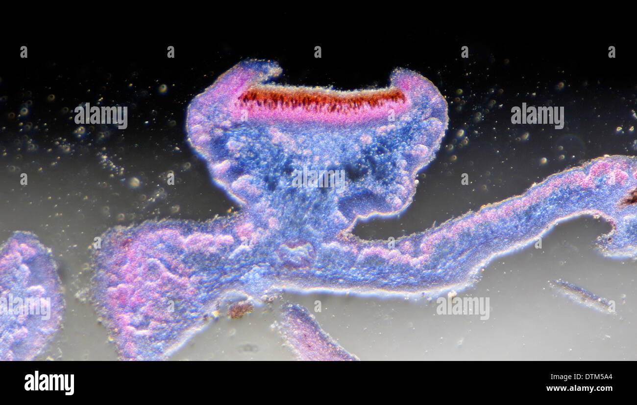 Darkfield microfotografía, los líquenes Parmelia Apothecia Tallo, tiñe la sección Aristolchia VS hongos en simbiosis con Pleurococcus Foto de stock