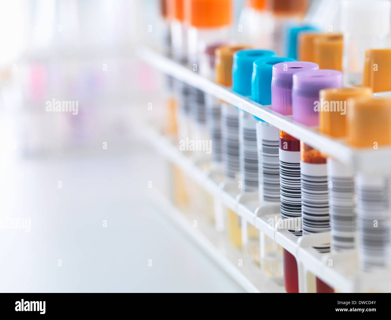 Una fila de muestras humanas para pruebas analíticas, incluyendo sangre, orina, química, proteínas, anticoagulantes y el VIH en el laboratorio Foto de stock