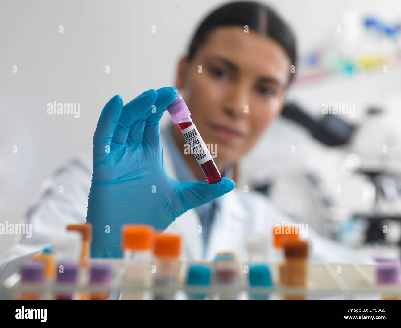 Doctor prepararse para ver muestra de sangre bajo el microscopio en el laboratorio de pruebas médicas Foto de stock