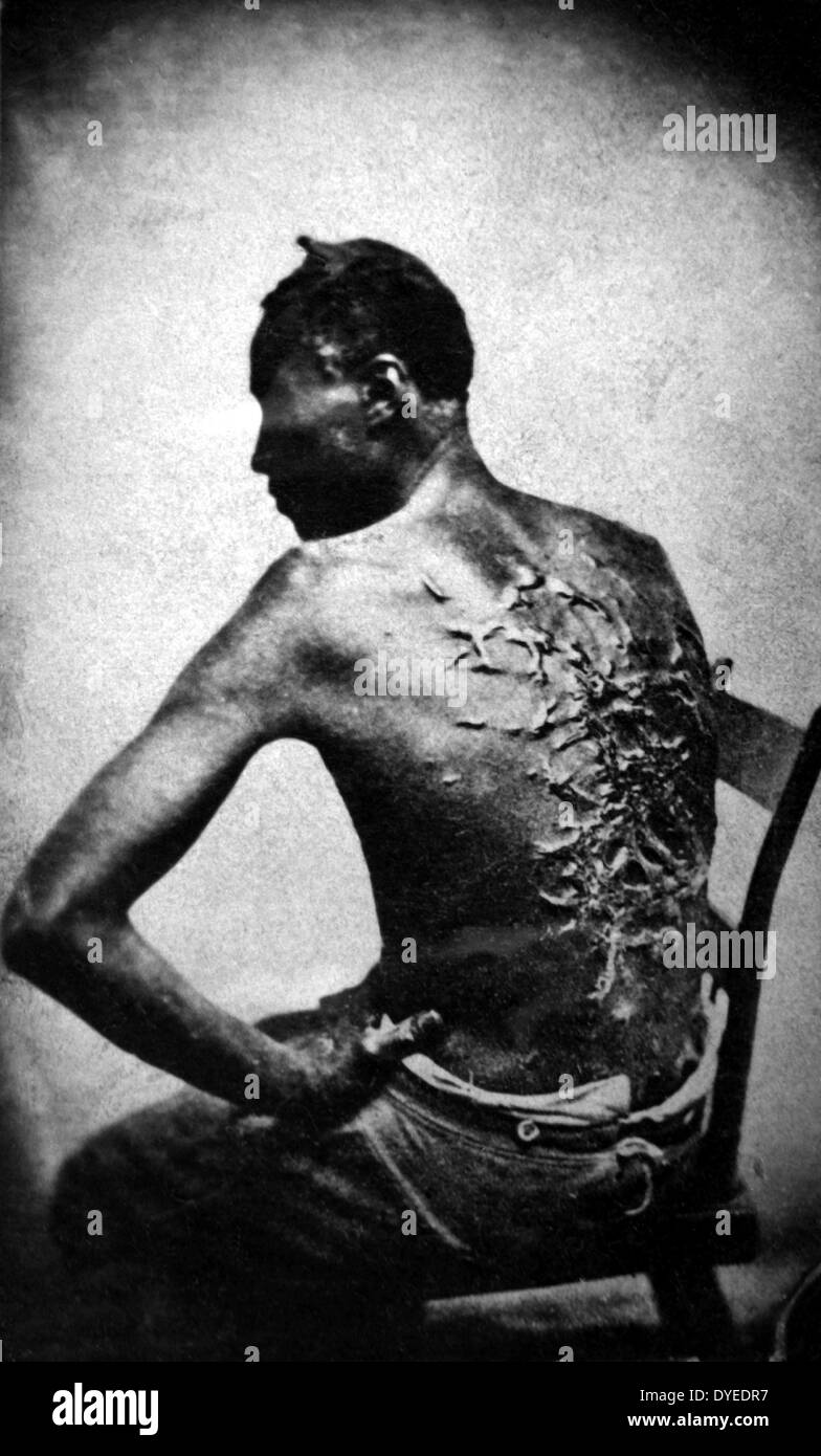 Macho negro africano con tejido cicatricial en la espalda de ser azotado 1863 Foto de stock